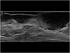 Ultrasoundinfo - Case of the month