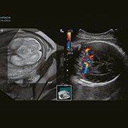 Real-time virtual Sonography