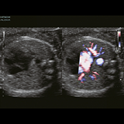 Blood flow in high resolution