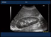 Abdominal image