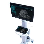 Product Picture for ARIETTA Precision