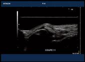 Ankle joint