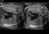 Dynamic Slow-motion Display of the fetal heart
