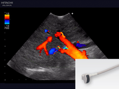 Portal vein and hepatic artery blood flow 