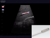 Intraoperative assessment of liver vasculature 