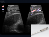 Laparoscopic investigation of hepatic vasculature 