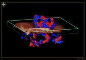 3D display of blood flow in the umbilical cord using Flow 3D