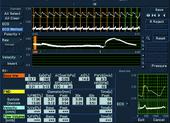 WI - Wave Intensity