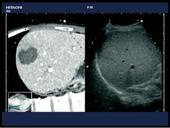 Real-time Virtual Sonography