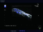 Minute vessels streaming in fingertips sensitively shown by eFLOW