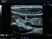 Digestive tract with outstanding image quality