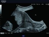Uterine cervix in a wide field of view