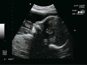 OBGYN - Fetal profile
