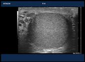 Testicular Ultrasound