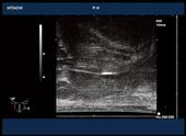 Sagittal view